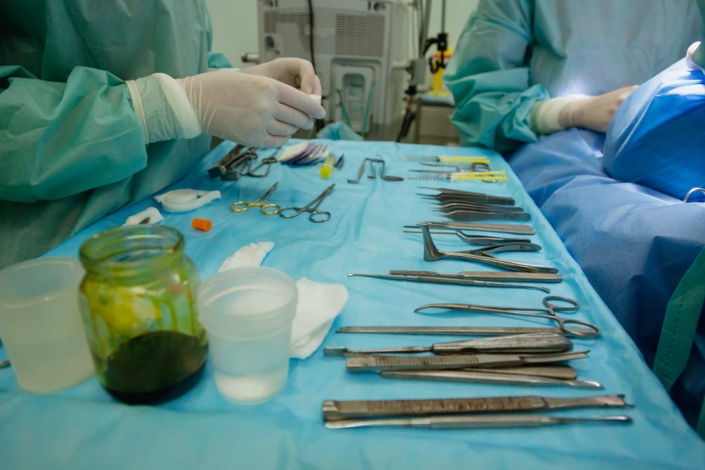 Avoid Liposuction Surgery